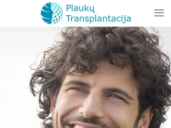 „Plaukų transplantacija“ svetainė – mobilioji versija