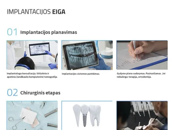 „Vilnius Dental Clinic“ svetainė – vaizdas 4