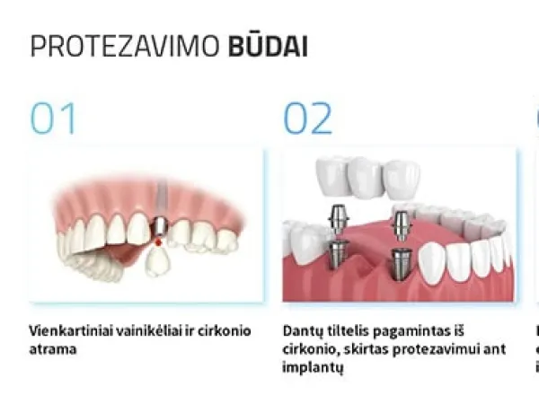 „Vilnius Dental Clinic“ svetainė – vaizdas 12