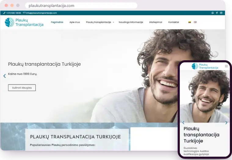 „Plaukų transplantacija“ svetainė kompiuterio ir telefono ekranuose